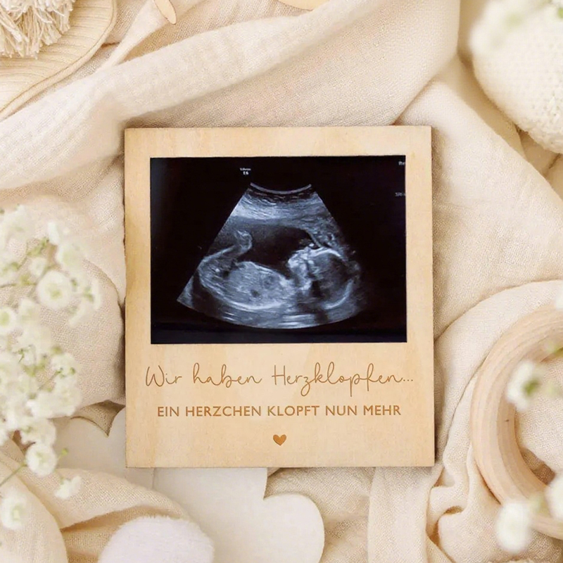 Ultrasound Pregnancy Announcem - Photo Booth Frame avis et prix