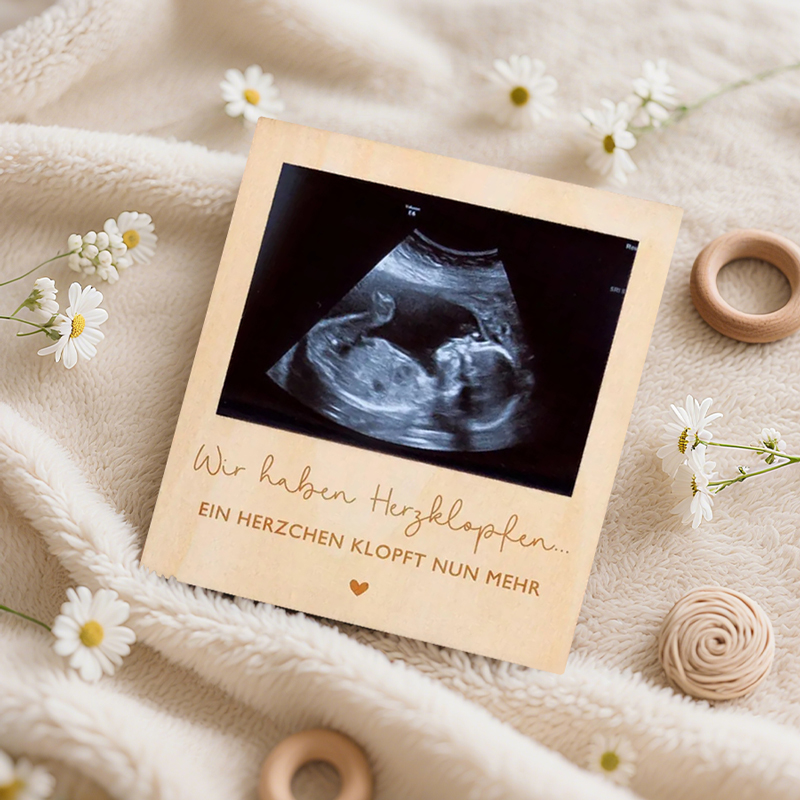 Ultrasound Pregnancy Announcem - Photo Booth Frame avis et prix