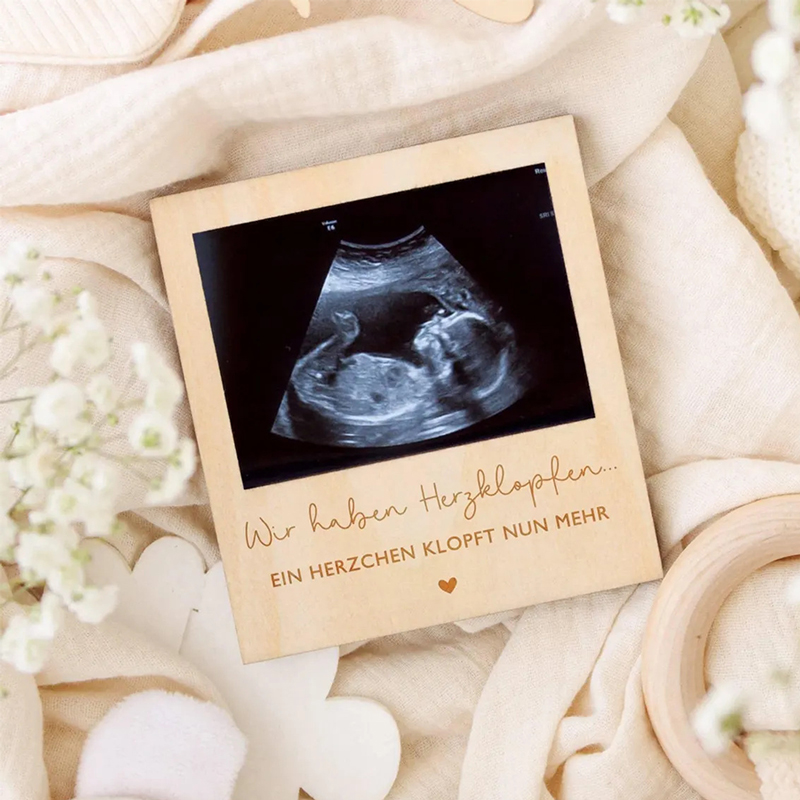 Ultrasound Pregnancy Announcem - Photo Booth Frame avis et prix